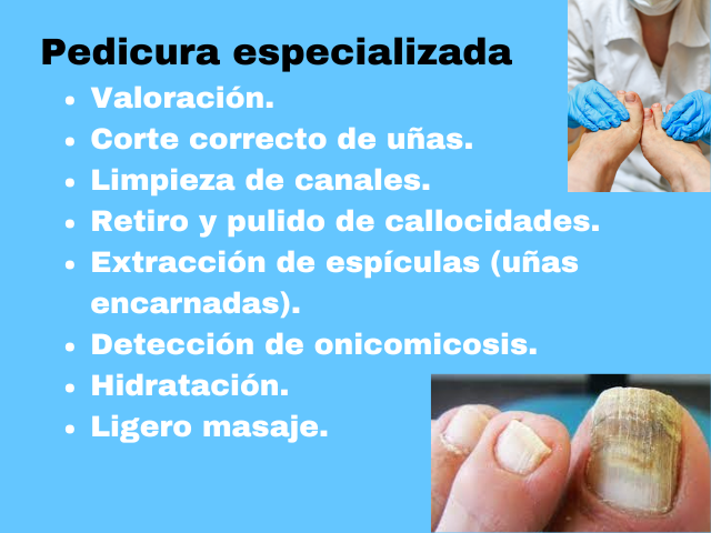 Pedicure especializado